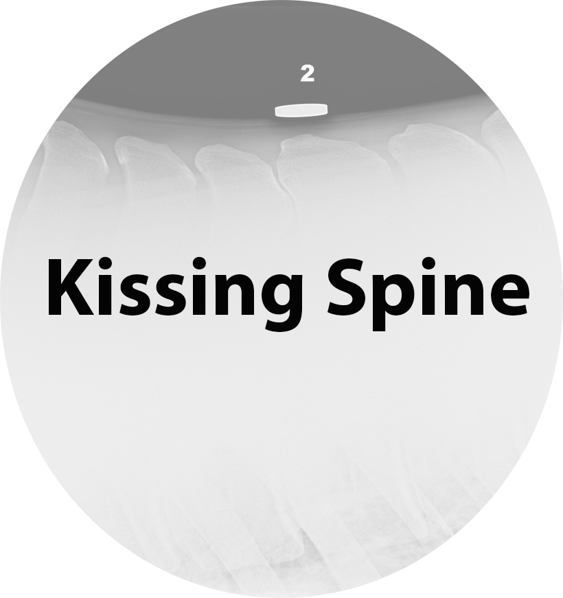 Kissing Spine.jpg